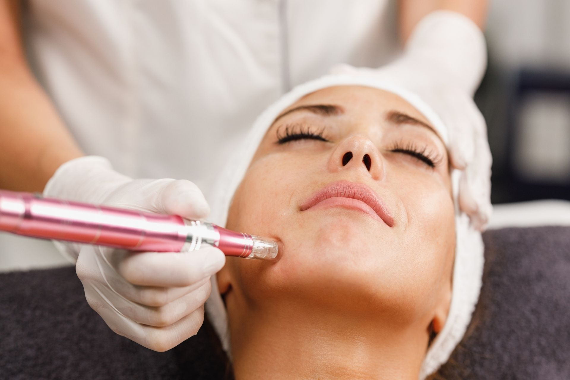 Dermapen treatment in Abu Dhabi