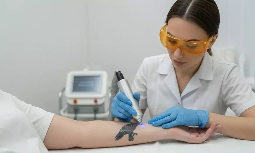 Laser Tattoo Removal in Abu Dhabi