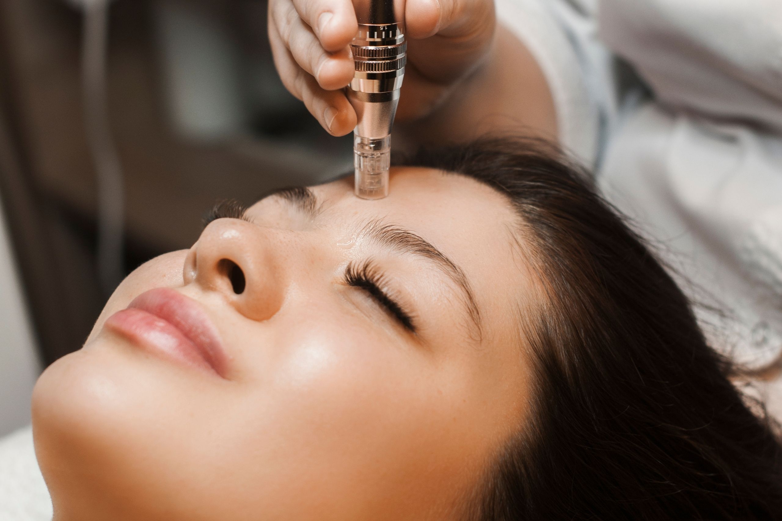 Microneedling Abu Dhabi