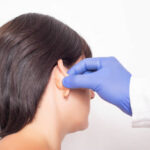 How Can Otoplasty Improve Overall Ear Appearance