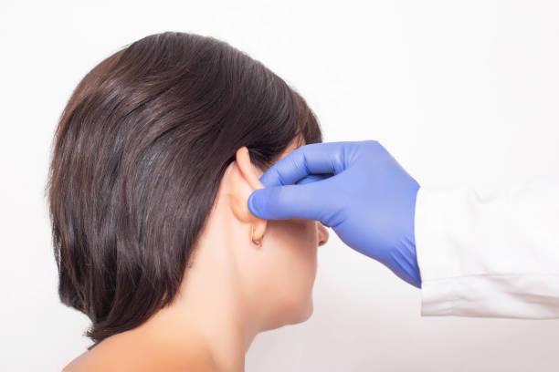 How Can Otoplasty Improve Overall Ear Appearance