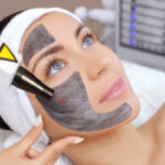 Spectra Laser Carbon Peel in Abu Dhabi