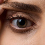 Is Eyelid Surgery Performed on Upper and Lower Lids
