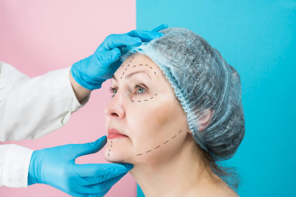 Is Facelift Effective for Jowls and Loose Skin