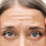 Forehead Lift in Abu Dhabi
