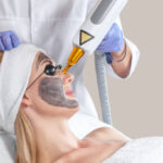 Is Laser Carbon Peel Effective for Skin Rejuvenation