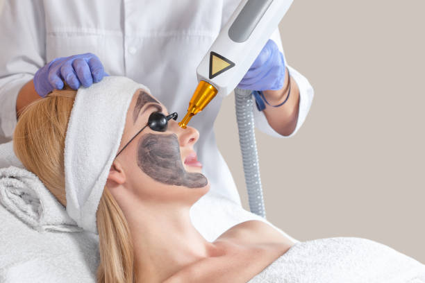 Is Laser Carbon Peel Effective for Skin Rejuvenation