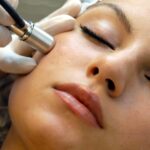 Microdermabrasion treatment Abu Dhabi