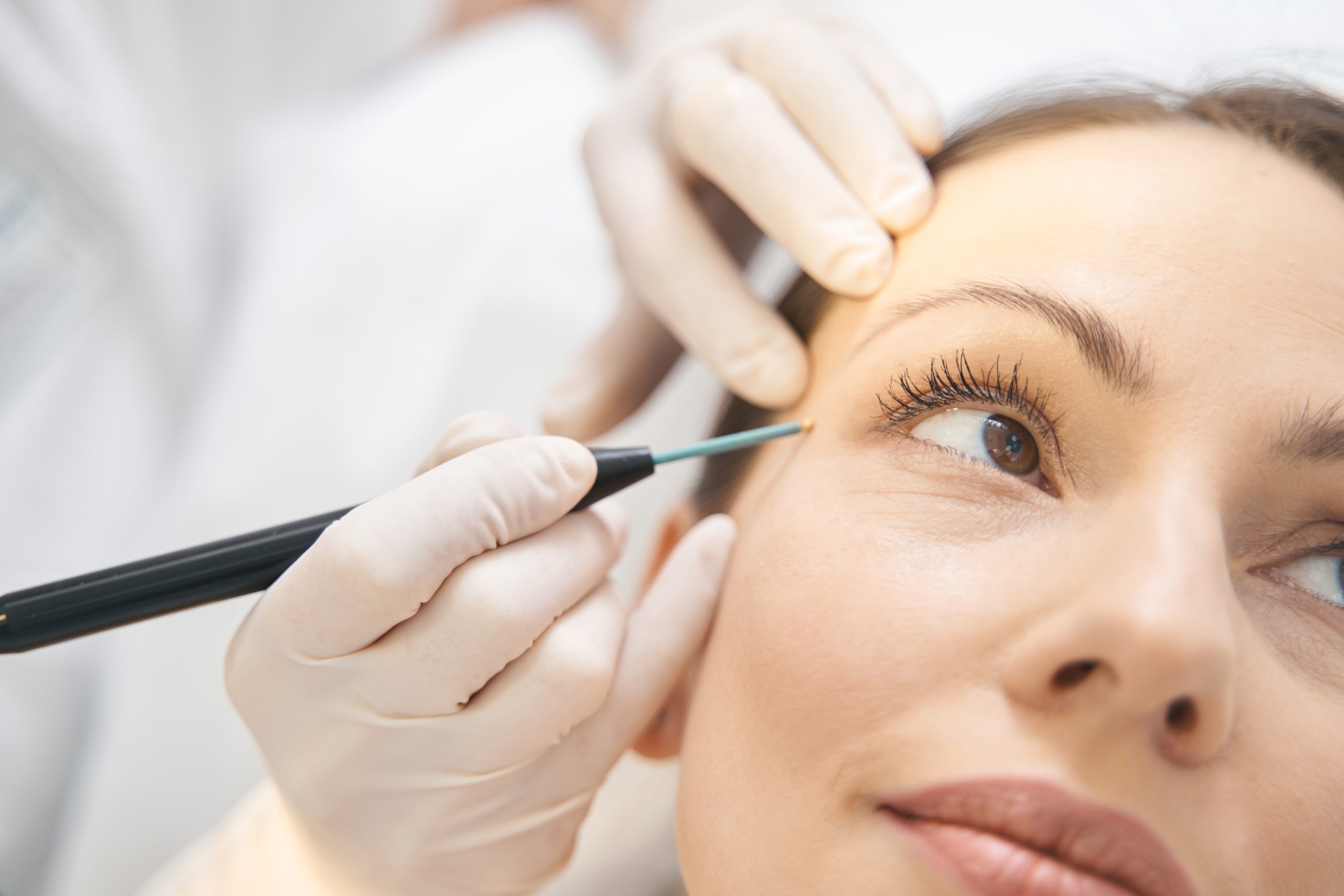 Mole Removal in Abu Dhabi