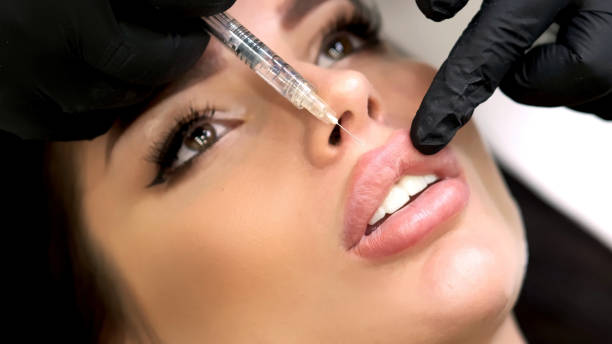 Transform Your Lip Shape with Lip Fillers