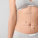 Mini gastric bypass in Abu Dhabi