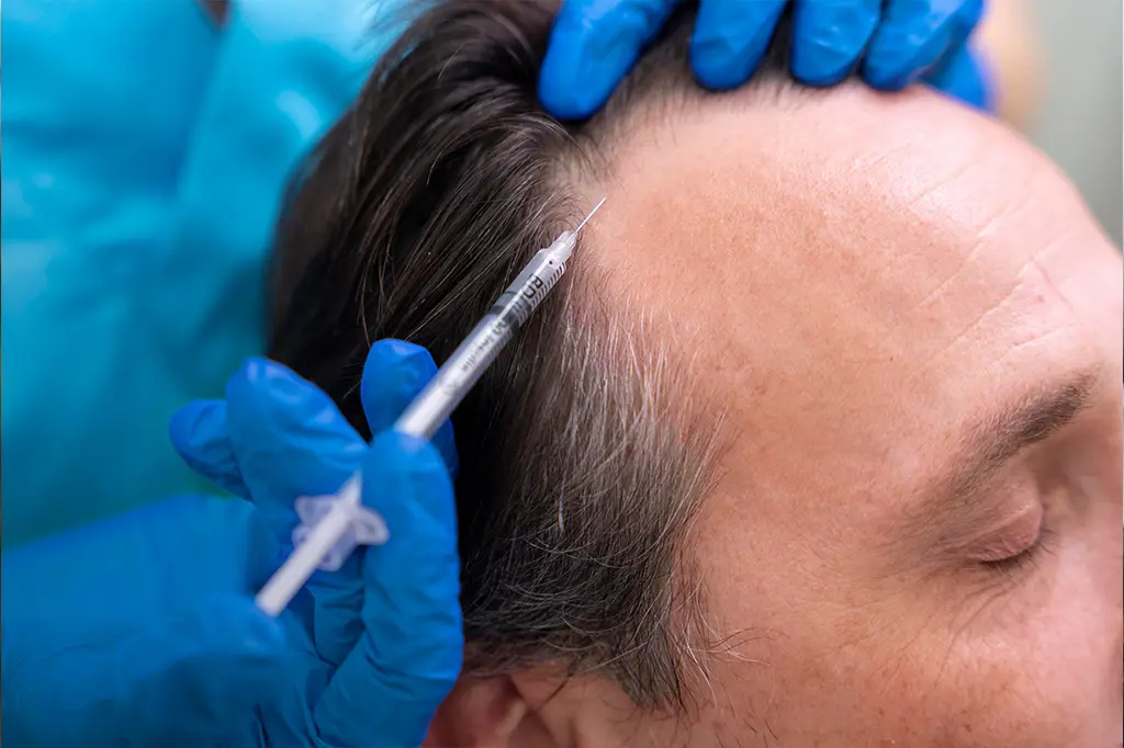 Acell PRP Treatment in Abu Dhabi