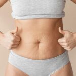 Experience Tailored Abdominal Contouring with Mini Abdominoplasty