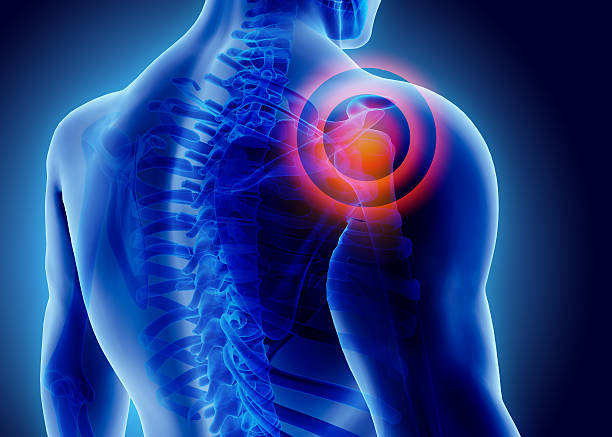 Regenerative Medicine for Rotator Cuff in Hyderabad: Explore Advanced Non-Surgical Care