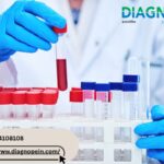 Diabetes Test in Pune – Affordable Blood Sugar Testing Services