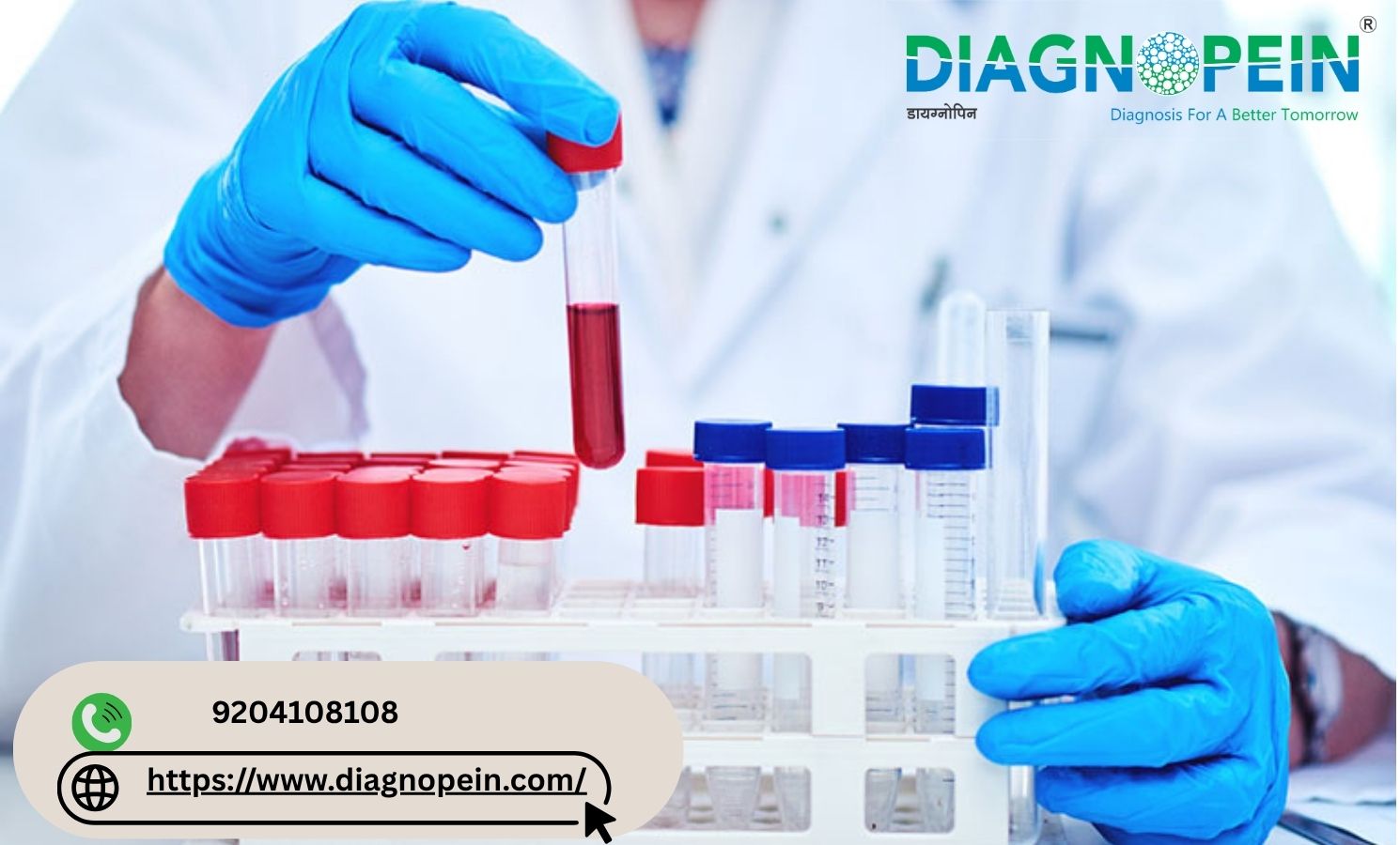 Diabetes Test in Pune – Affordable Blood Sugar Testing Services