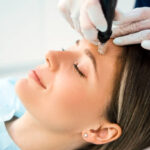 Can Fractional RF Micro Needling Help With Sagging Skin