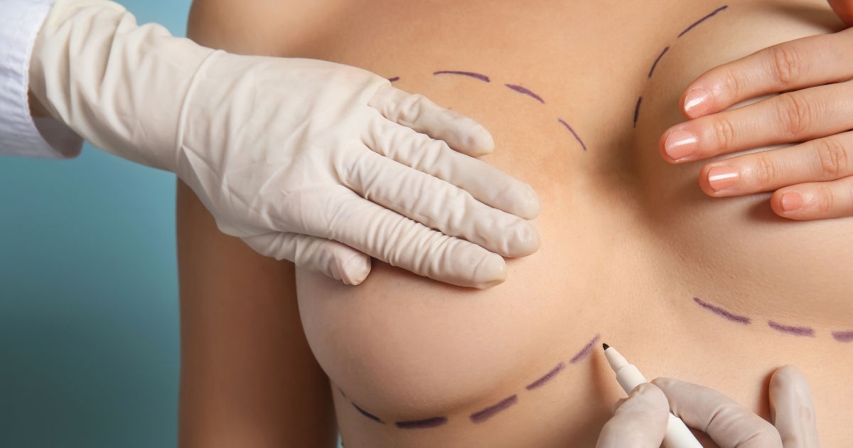 Breast Lift Surgery Abu Dhabi