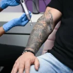 Discover Targeted Skin Solutions with Laser Tattoo Removal Abu Dhabi