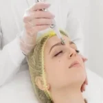 Experience Innovative Skin Rejuvenation with Exosome Therapy