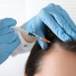 How Long Does PRP Hair Treatment Take to Work