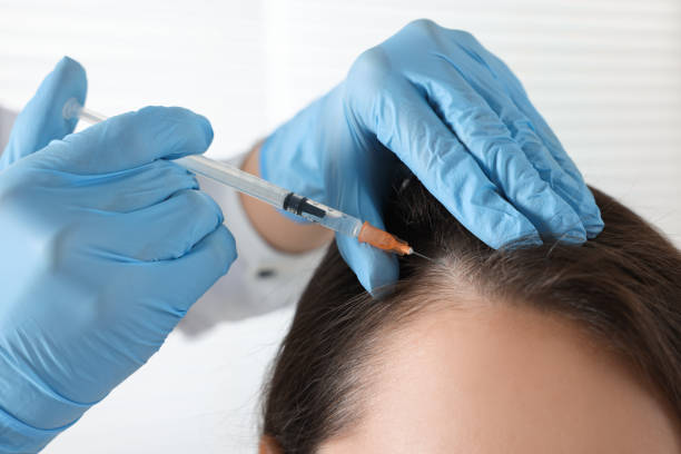 How Long Does PRP Hair Treatment Take to Work