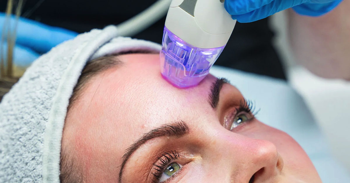 RF Micro Needling Abu Dhabi