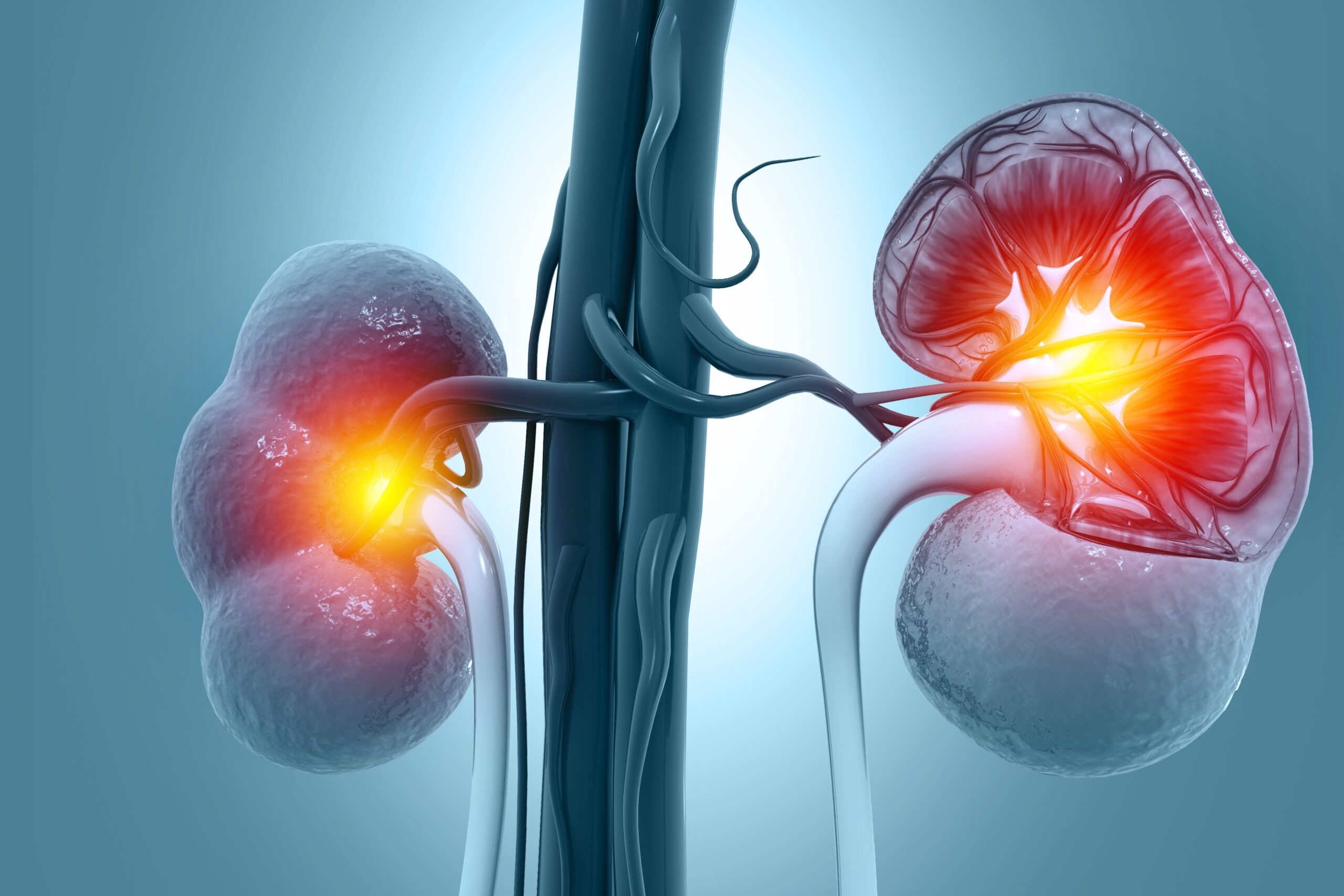 minimal change disease treatment