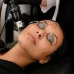 Rejuvenate Your Skincare Journey with Pico Laser Treatment