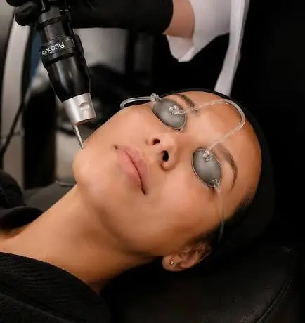 Rejuvenate Your Skincare Journey with Pico Laser Treatment